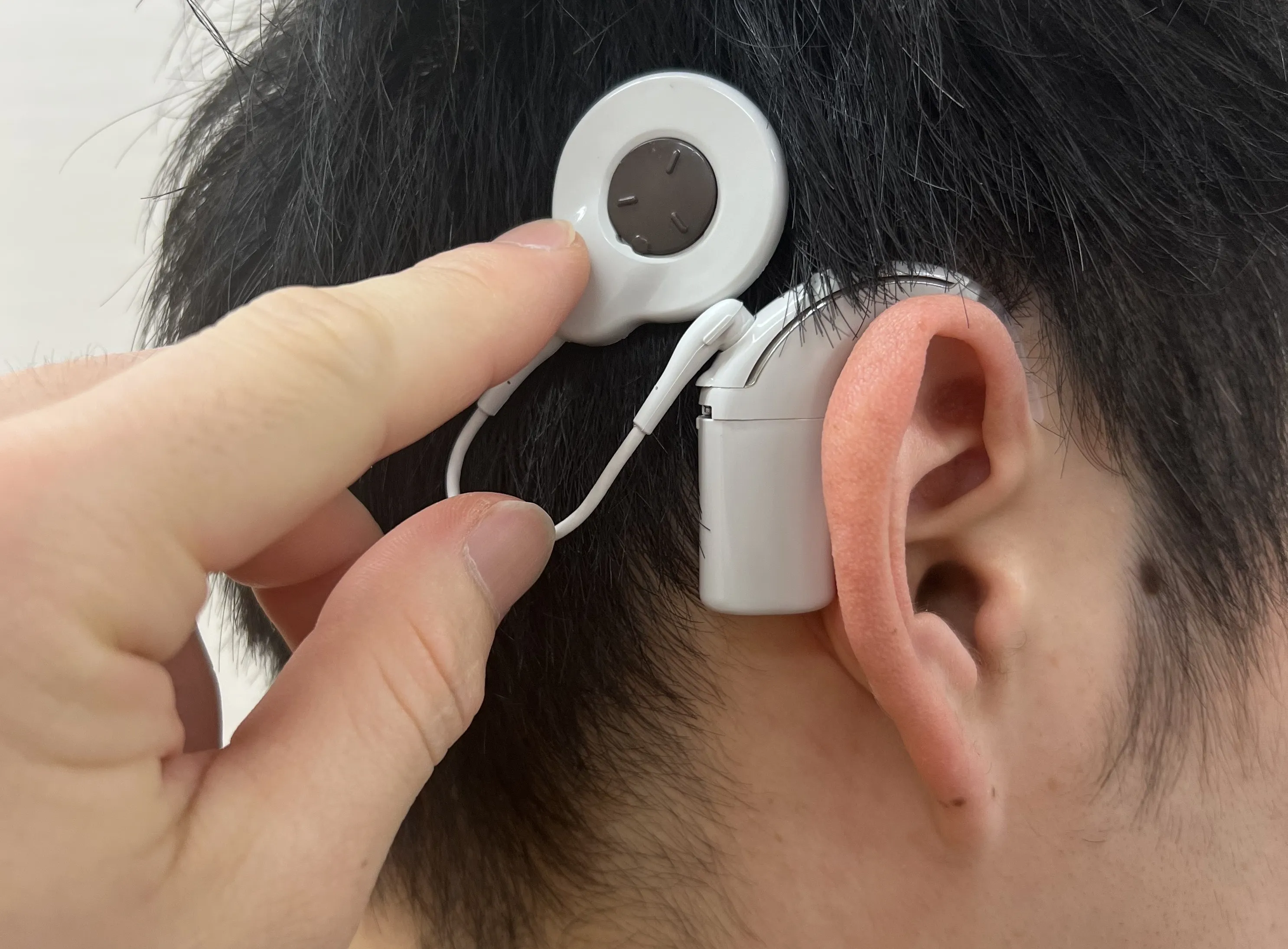 人工内耳を装着している様子